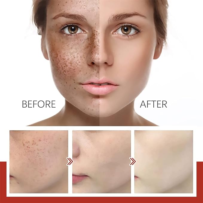 Pigment Correcting Cream