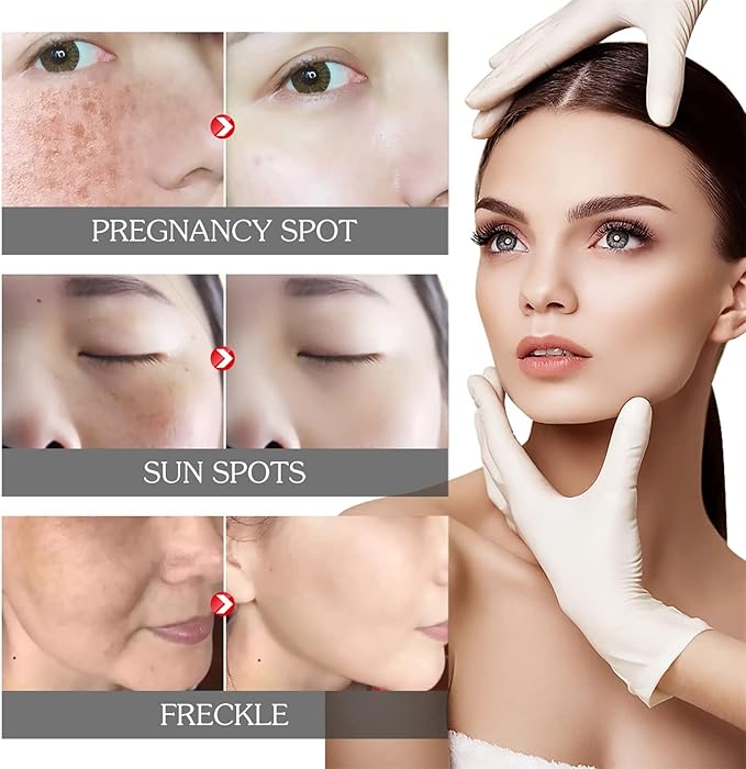 Pigment Correcting Cream